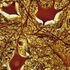 Sclerosi multipla: così muoiono i neuroni nella corteccia cerebrale