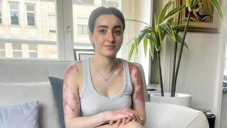 Il sorriso, le cicatrici, la cura