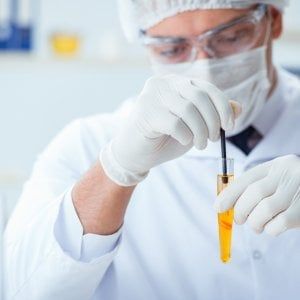 Un test delle urine per diagnosticare il tumore alla prostata