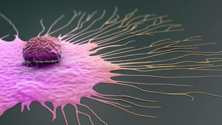 Esmo, tumore al seno triplo negativo: con anticorpo farmaco-coniugato aumenta la sopravvivenza