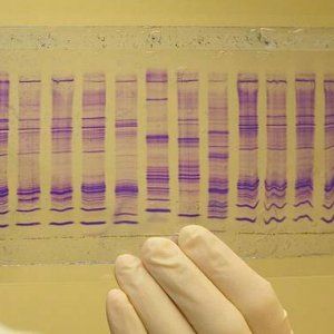 Tumori: 'biopsia liquida' dalla saliva. Risultati in 10 minuti