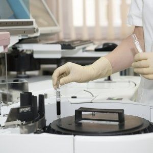 Linfoma di Hodgkin classico: immunoterapia efficace nei casi più difficili