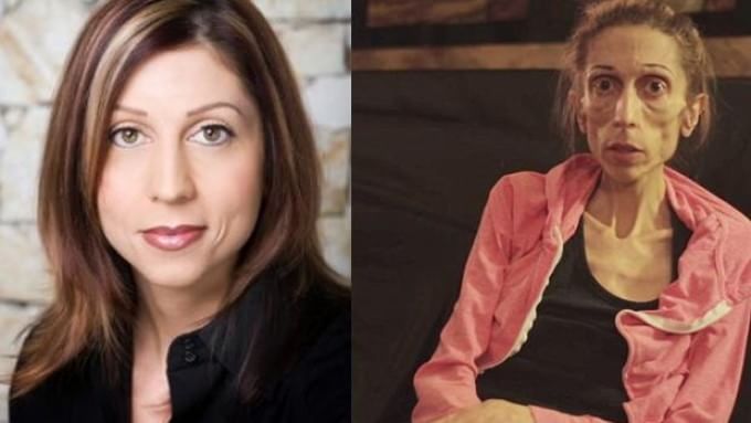 Sul web la richiesta di una modella: "Aiutatemi sto morendo di anoressia"