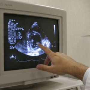 Ictus, negli Usa il 73% dei giovani non sa riconoscere i sintomi