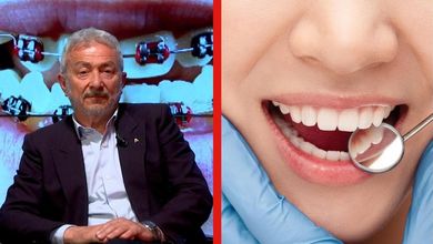 Come avere l'apparecchio dei denti gratuitamente con il Ssn? La risposta del dentista