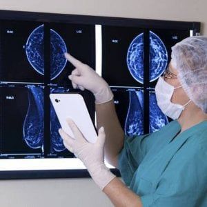  Creata la mappa delle mutazioni genetiche del cancro seno