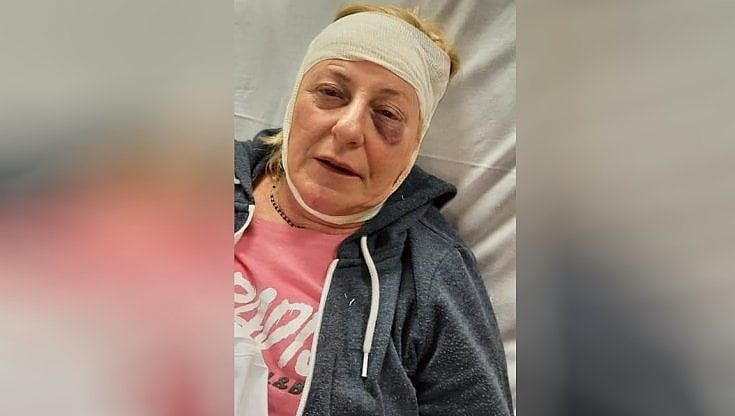 Alessandria, "Sei una lesbica di m...": il vicino la picchia e la butta giù dalle scale