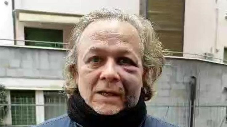 Pestaggio in San Mamolo, è caccia agli aggressori. “In tanti solidali, grazie”