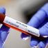 Coronavirus, l'Oms: 