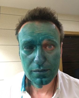 Russia, confermata condanna a Navalny: "Rischio di perdere 80% di vista da un occhio"