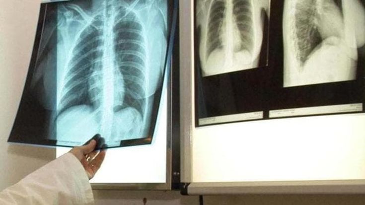 Radiologo spogliava, palpeggiava e filmava pazienti e bambine. “Va condannato per violenza sessuale”
