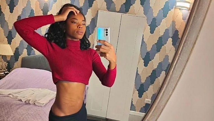 Tracy: "Le mie cicatrici per dare voce alle donne. Perché vittima non è vittimismo, basta toglierci la dignità"