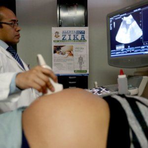 Zika, caso in Texas: "Trasmissione per via sessuale"
