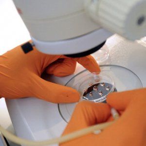 Lotta alla Sla con le staminali ricerca possibile anche a Parma 