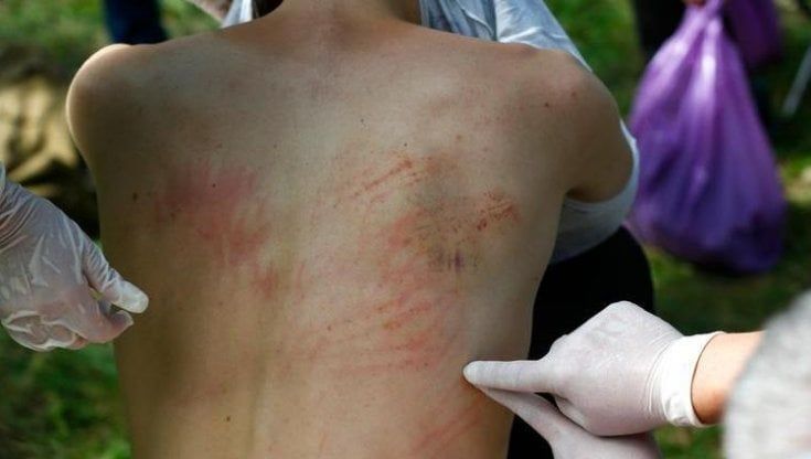 Bielorussia, le violazioni dei diritti umani nelle carceri e l’impunità per i torturatori autori di pestaggi spietati 