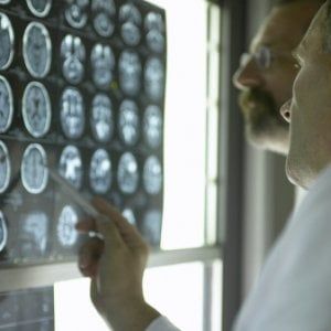 Big killer, ecco i cinque tumori più diffusi in Italia 