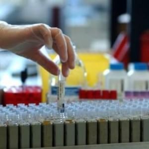 Scontro sui laboratori d'analisi privati: budget tagliato del 20 per cento