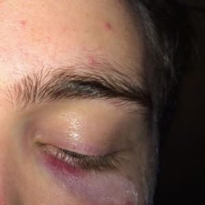 "Aggressione omofoba, pensavo a uno scherzo, poi uno mentre scendeva mi ha tirato un pugno"