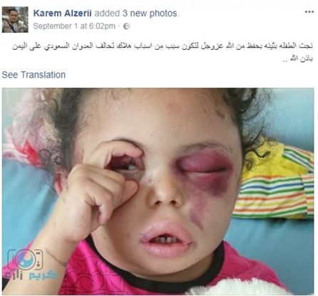 Buthaina, la bambina sopravvissuta che sta aprendo gli occhi al mondo sulla guerra in Yemen