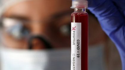 Coronavirus, vero o falso? Attenti ai falsi rimedi e agli untori della serie tv