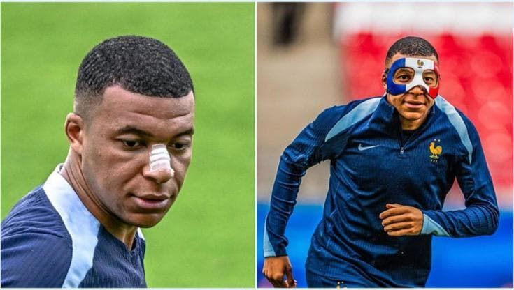 Mbappé si allena con maschera che gli protegge il naso. E che gli dà molto fastidio