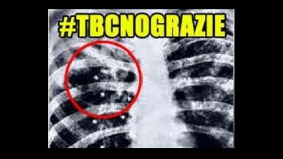 Grillo: "Tbc, no grazie. I migranti portano malattie infettive"