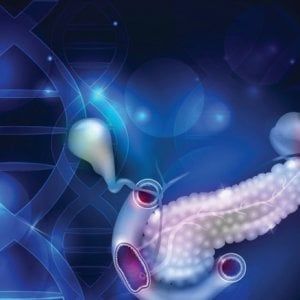 Tumore al pancreas, nasce la Federazione di associazioni dei pazienti