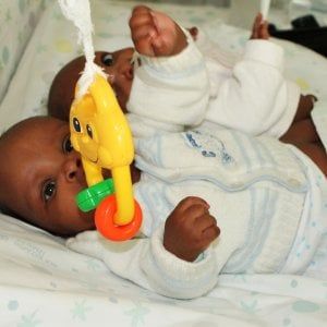 Francine e Adrienne, le gemelline siamesi operate in Italia tornano in Burundi