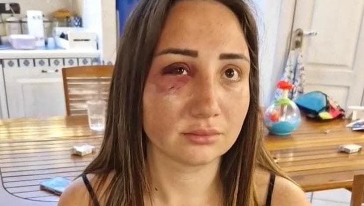 Gaia, la ragazza picchiata dal suo ex a Pozzuoli: “Appena lo liberano torna e mi ammazza”