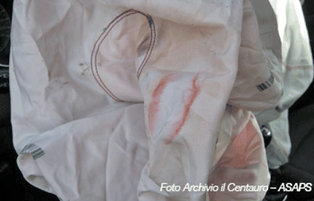 Caro airbag, ti bacio...