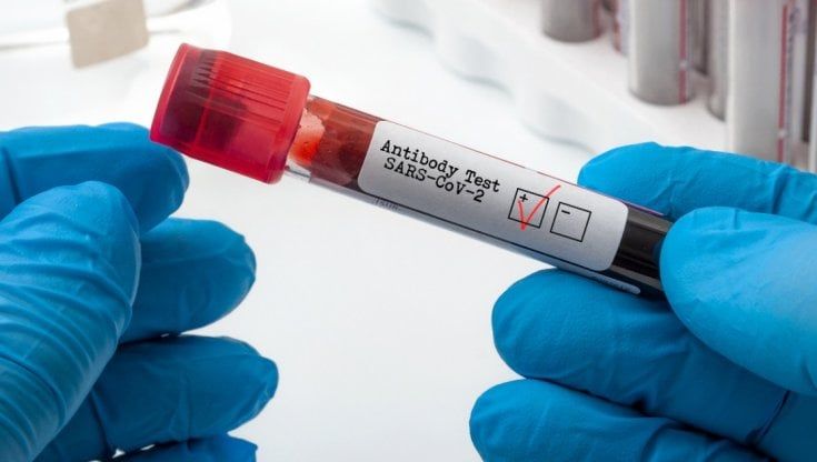 Covid, un nuovo test rapido ci dirà quanto siamo immuni al virus
