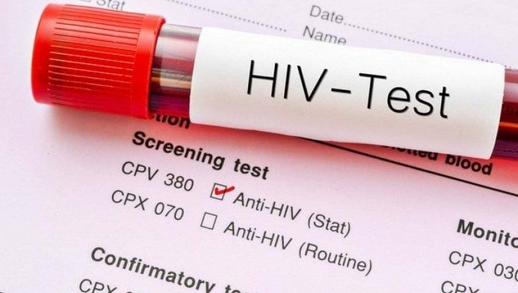 Hiv e papilloma, Sicilia in ritardo nella prevenzione: l'allarme degli esperti