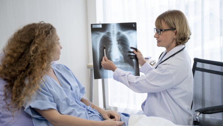 Tumore del polmone, i pazienti preferiscono l’immunoterapia sottocute