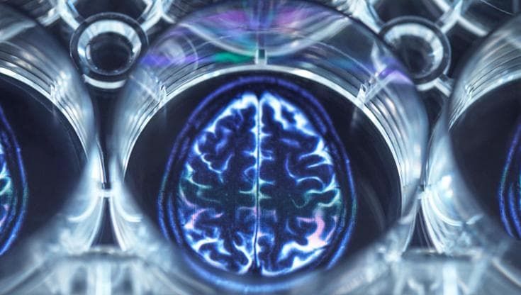 Alzheimer, a che punto è la ricerca di nuovi farmaci e per chi sono indicati