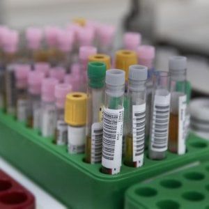 Coronavirus, la scelta controcorrente di Trino Vercellese: "Test sierologici a tutta la popolazione"
