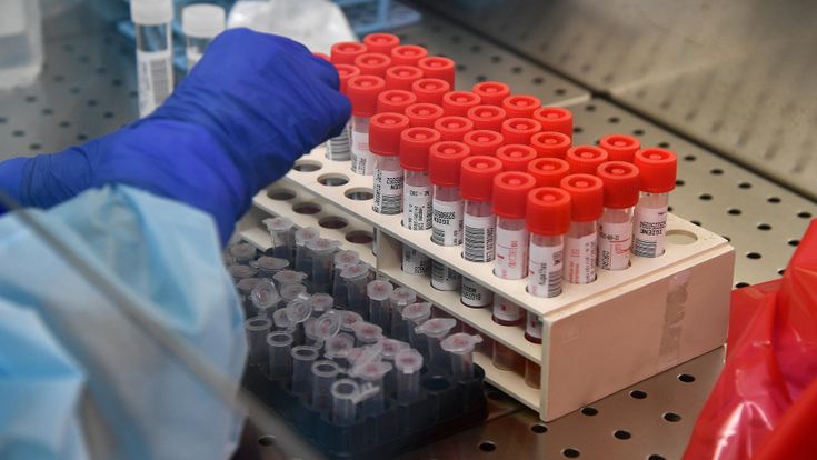Migliaia di test privati sul coronavirus in Lombardia, ma la Regione non li usa per misurare la diffusione dell'epidemia