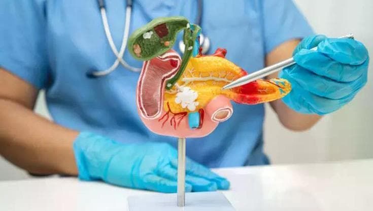 Attacco al pancreas il tumore che fa più paura nel mirino della scienza
