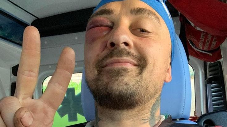 Chef Rubio sentito per un’ora dalla Digos: l’identikit degli aggressori in procura, caccia alle telecamere