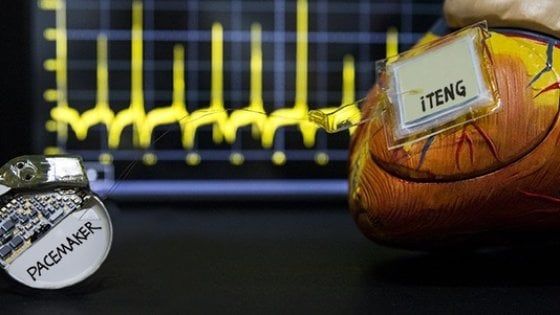 Un pacemaker senza batteria: ricava elettricità dai battiti del cuore