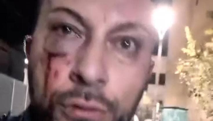 Circum, vigilante massacrato di botte denuncia: "Ho difeso un treno Eav"