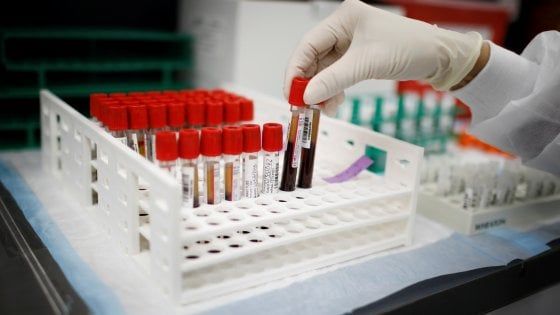 Coronavirus, al via uno studio della Regione Emilia Romagna per produrre plasma iperimmune
