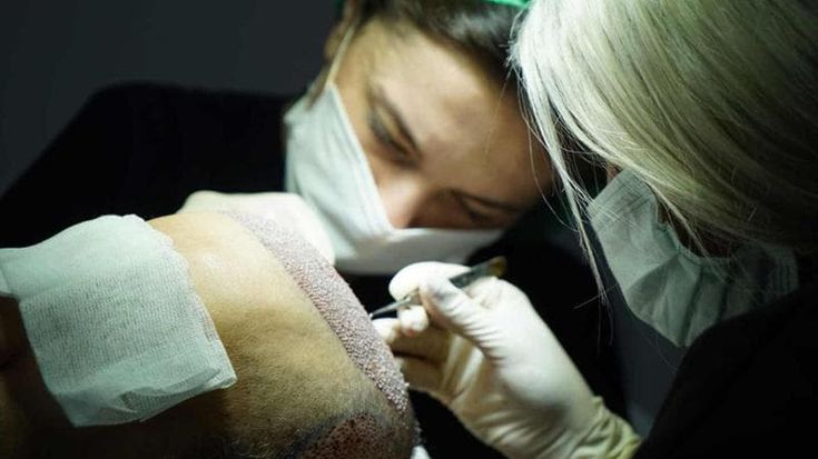 Trapianto di capelli, la Turchia domina. L’Europa: tutti i rischi