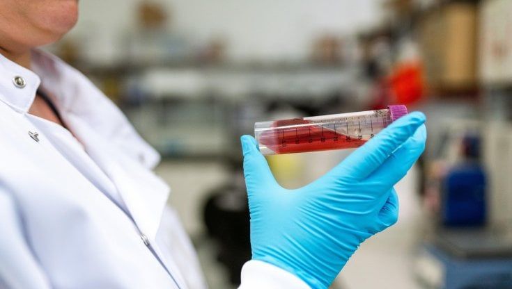 Linfoma a grandi cellule B, una nuova terapia all’orizzonte