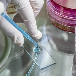 Ictus, pazienti recuperano funzioni dopo iniezioni di staminali nelle aree danneggiate del cervello