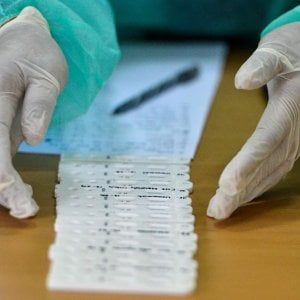 Test rapidi e sierologici Covid-19 per le aziende, come si procede ?