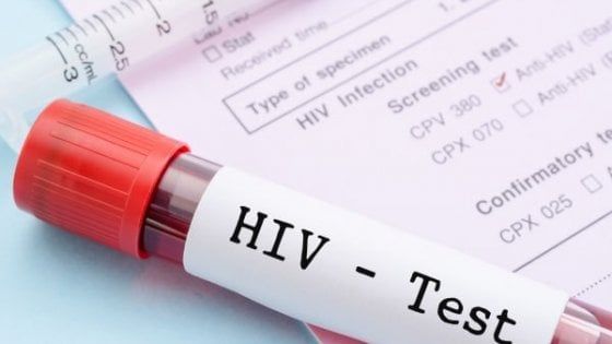 "Sesso non protetto senza avvisare la partner di avere Hiv", a Bari arrestato sieropositivo 