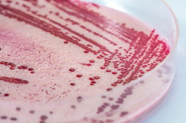 Batterio listeria, 12 morti in Danimarca