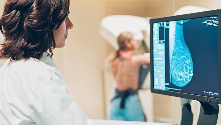 L'Università di Torino scopre proteina-interruttore contro i tumori al seno