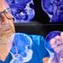 Tumori cerebrali, la nuova frontiera è decifrare la “carta d’identità” del glioma