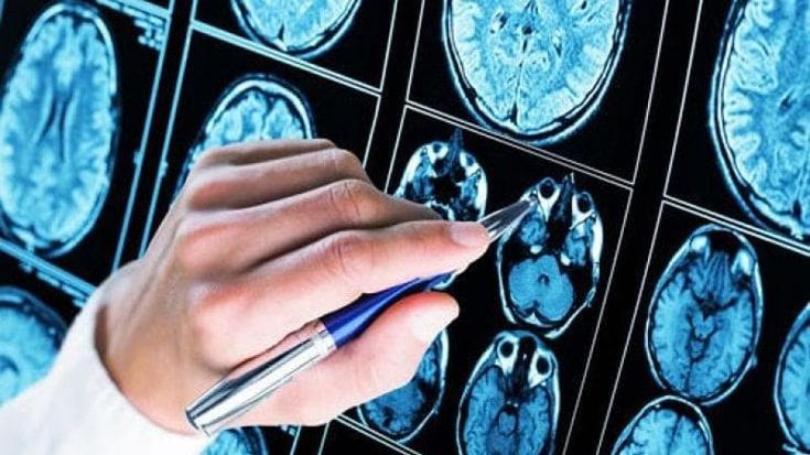 Alzheimer, oggi è la giornata mondiale. “In Italia 1,5 milioni di malati”
